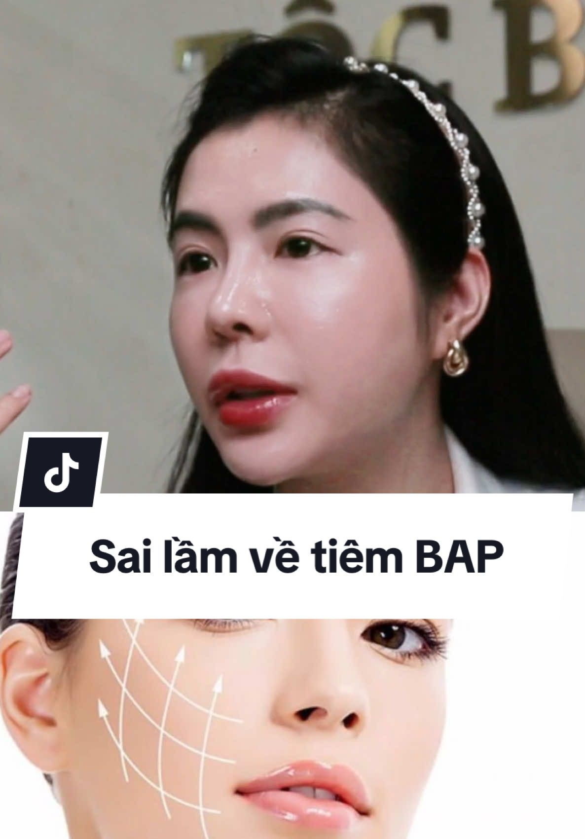 Sai lầm về tiêm BAP#skincareroutine #kienthucchamsocda #drnhungdalieu #tiembap