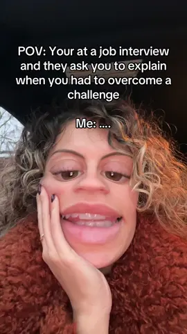 We have all been there 🤣🤣🤣 #interview #funny #comedy #comedian #skits #filter #fyp #viral_video #manchester 