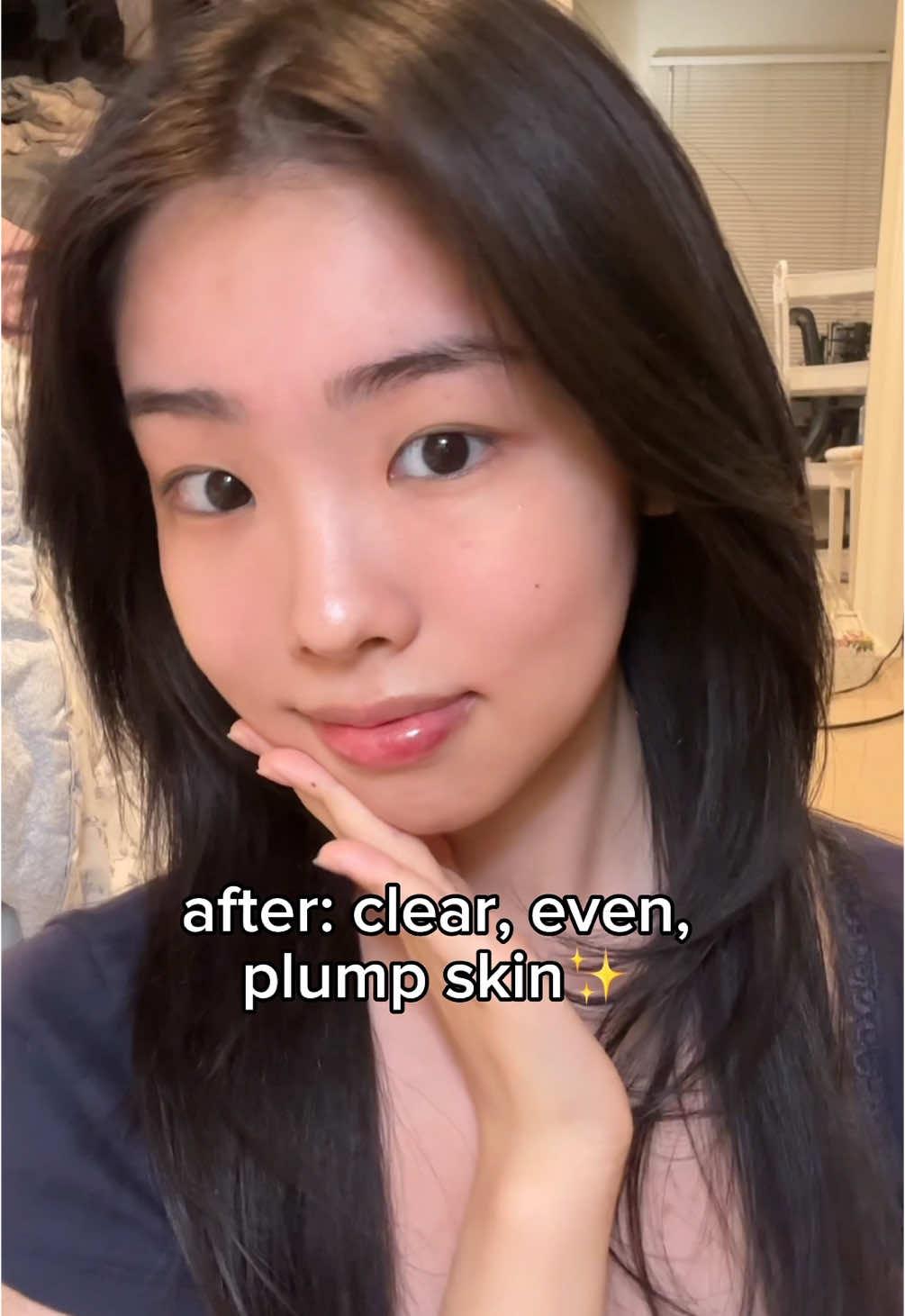 cant go wrong with this :3 #skincare #mixsoon #mixsooncentella #koreanskincare #glassskin #centellaasiatica #skincareroutine #skincaretips @Mixsoon US Official 