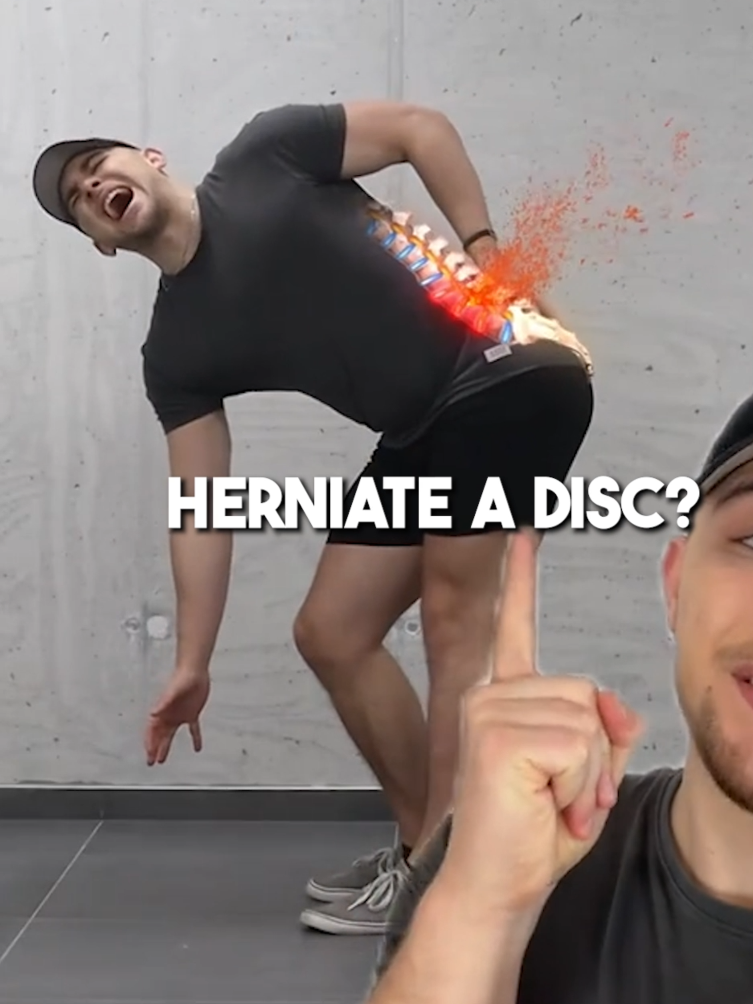 😨 What Happens When You Herniate A Disc? #backpain