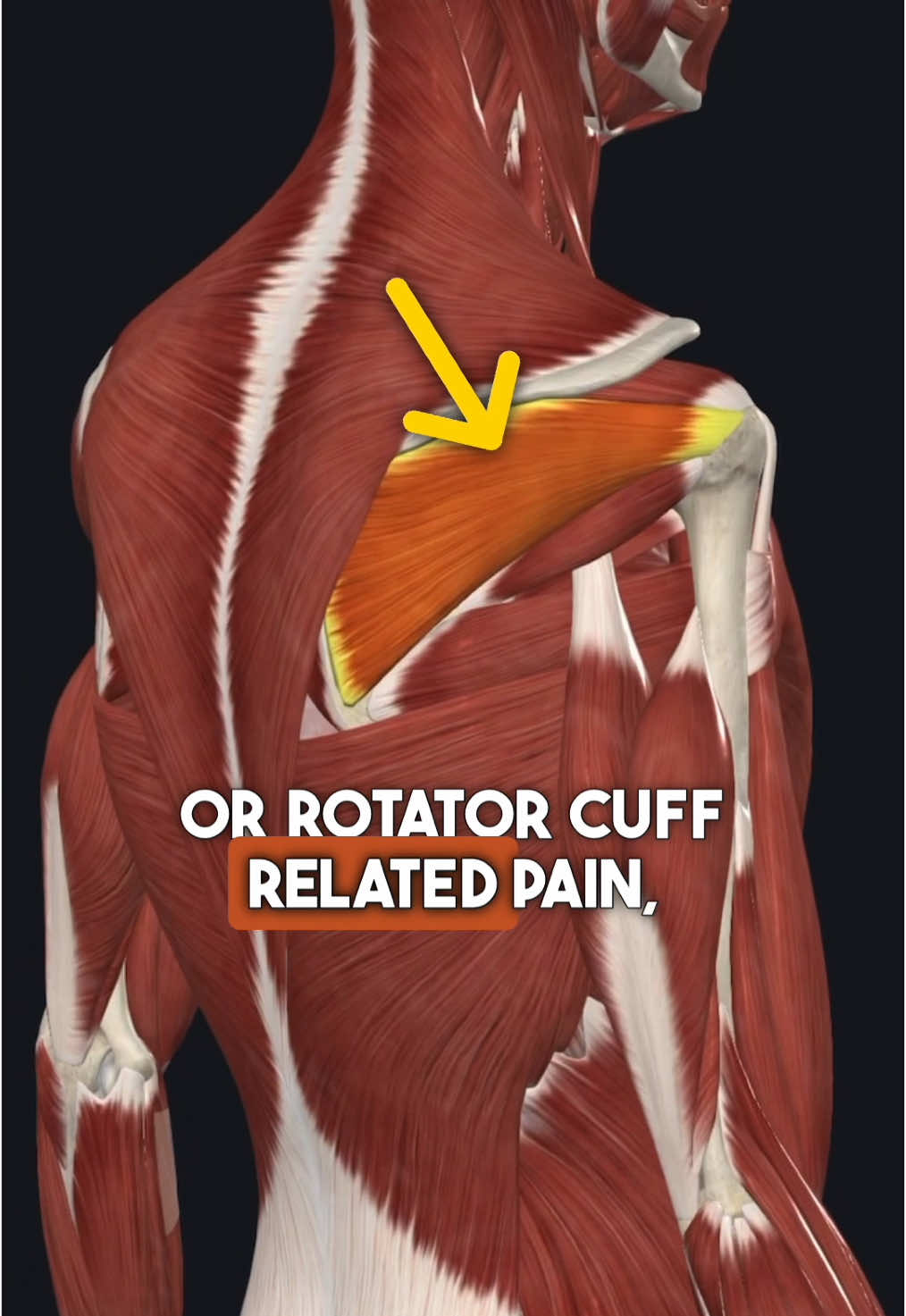 🎯 3 Critical Exercises for Eliminating Shoulder Pain! (Full program in my bio link) - #physicaltherapy #rotatorcuff #shoulderimpingement 