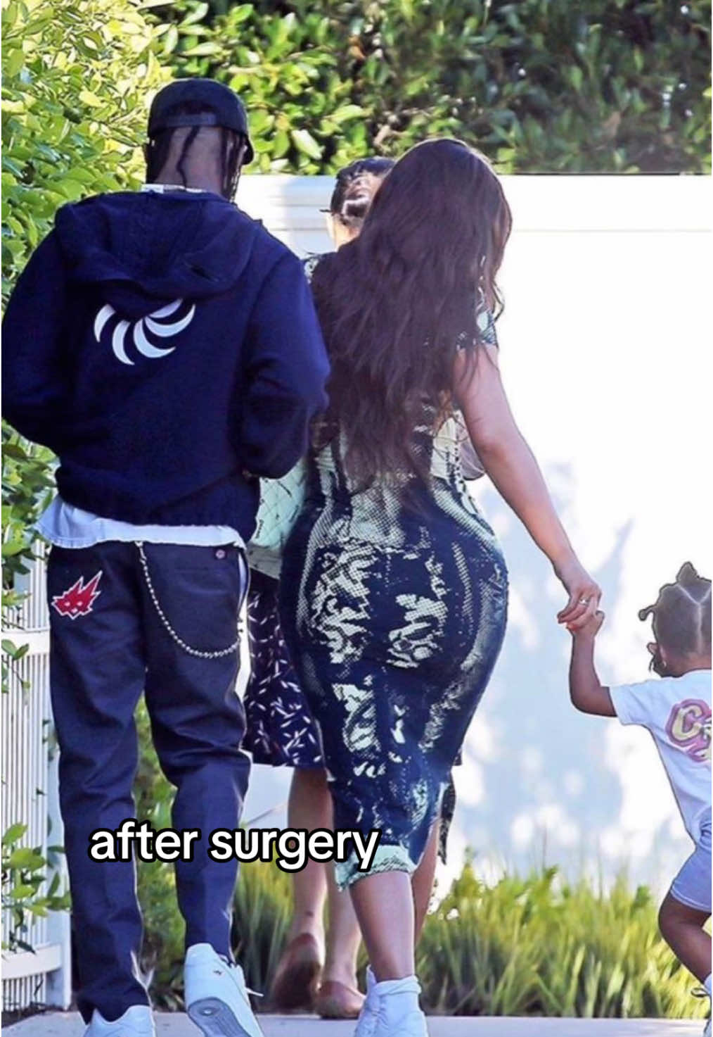 this is not a hate video!#kyliejenner #surgery #fyp #foruyou 