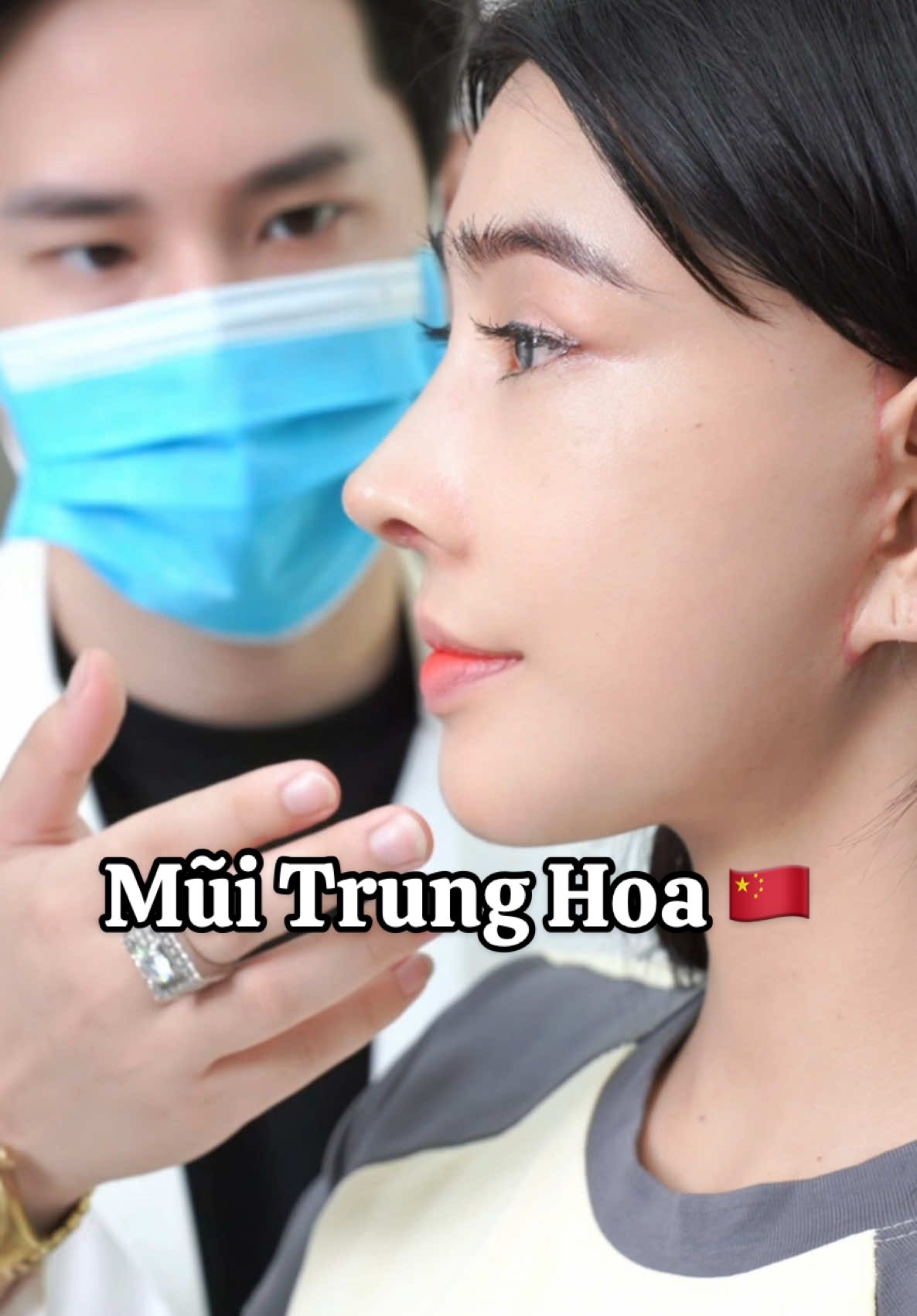 Cố ấy đã trải qua nhiều cuộc phẫu thuật để được trẻ đẹp. #chuyensuamuihong #muitrunghoa #muiphongthuy #nangmui #lamdep #ngan98 #drthong 