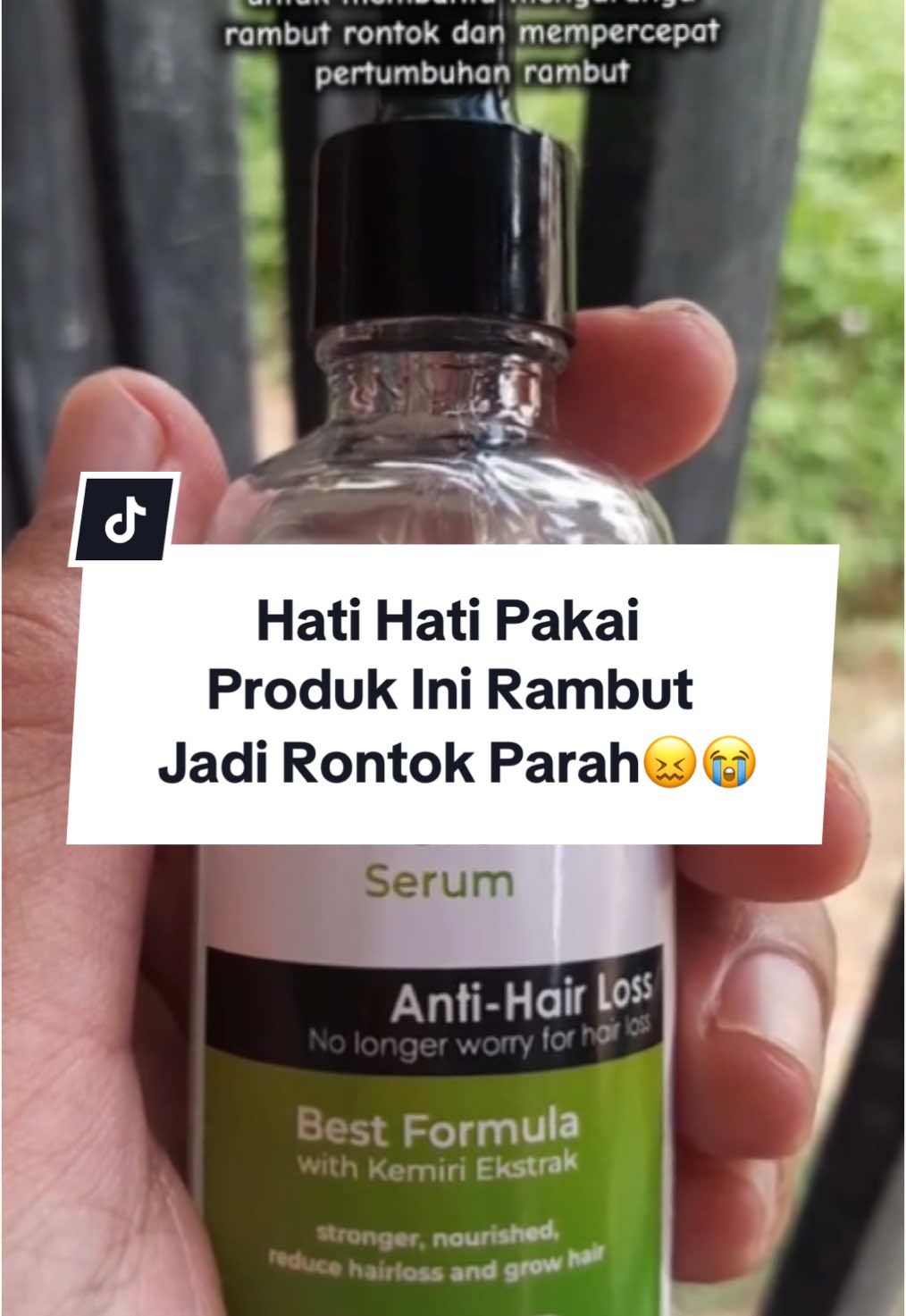 HAIR GROWTH SERUM bagus banget buat bantu ngurangin kerontokan & mempercepat pertumbuhan rambut.Langsung aja klik di keranjang kuning 😍 ✨#PromoGuncang11 #serumrambutviral #serum #myiwe #rambutrontok #myiwe #myiwehairgrowthserum #rambutrontok #serumrambutrontok #serumviral #viral #fyp #racuntiktok #belilokal #belilokaltiktok 