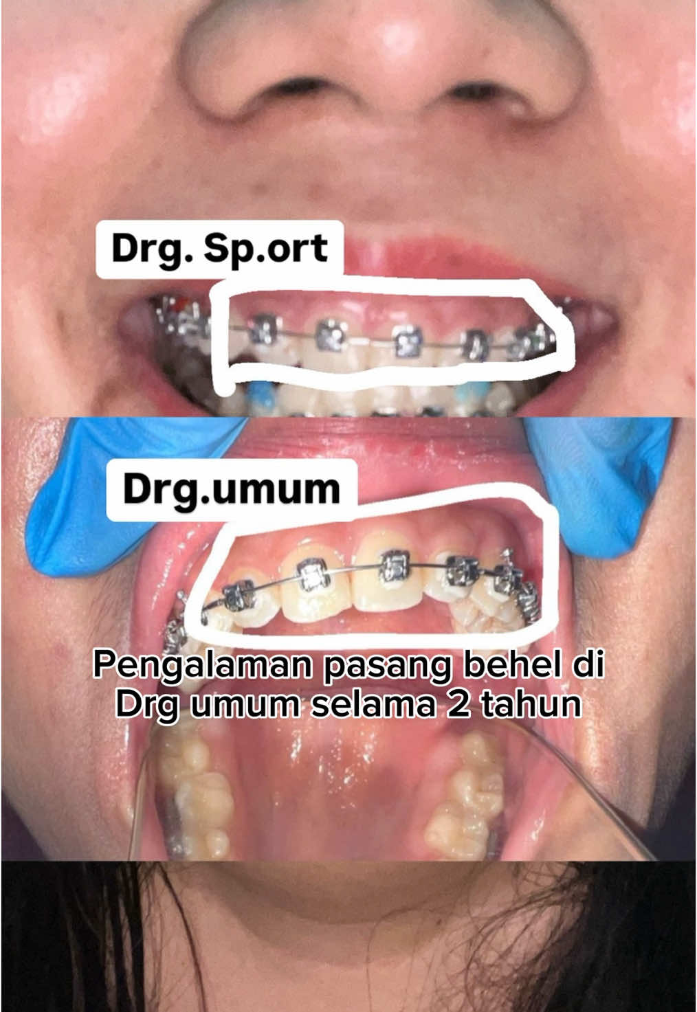 Sharing pengalaman aku pribadi pindah dari drg umum ke drg sp ort#CapCut 