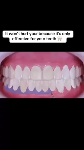 I use it everyday #tiktok_india #tiktokmademebuyit #spotlight #clean #teeth #teethwhitening 