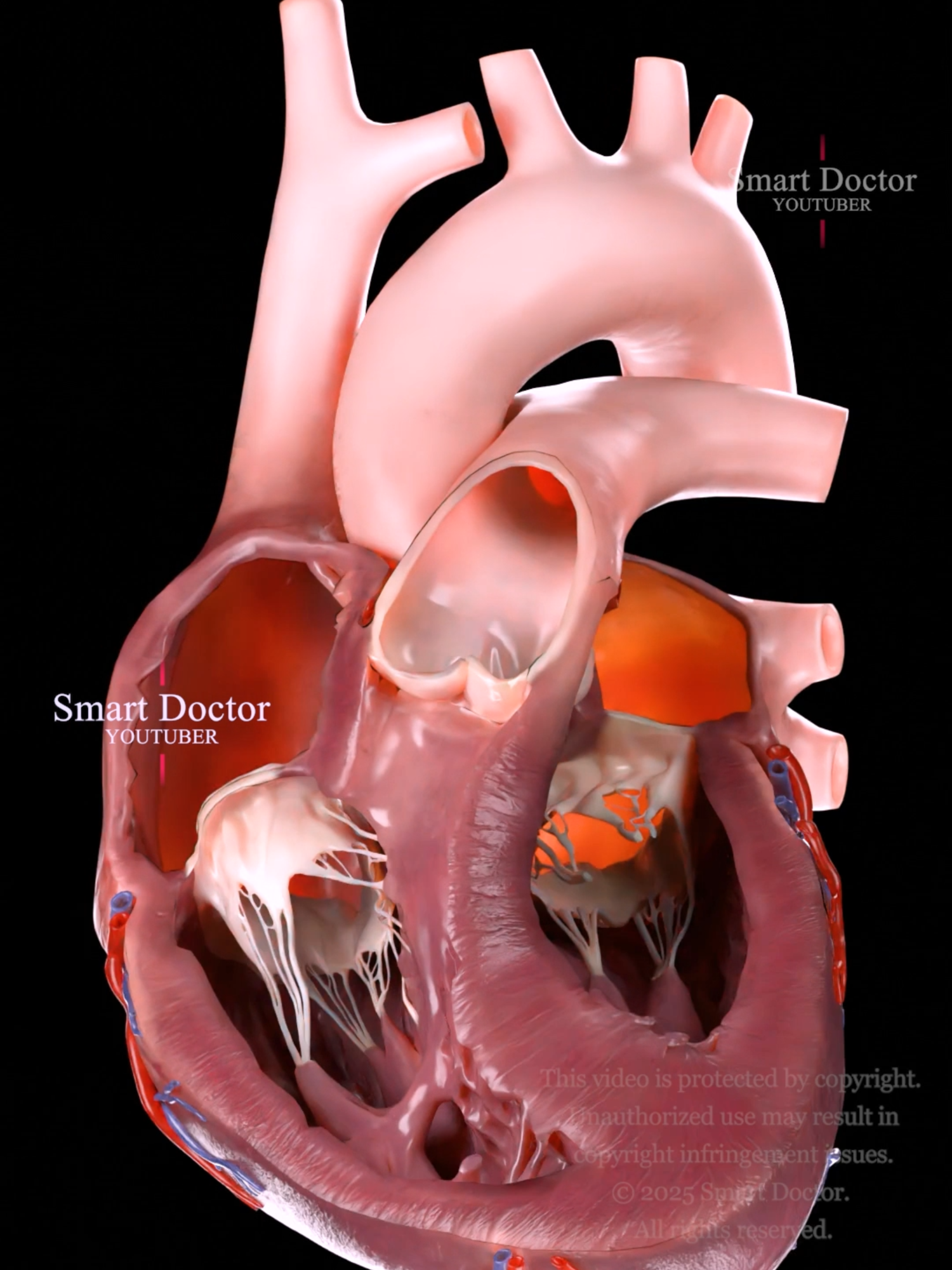 #TikTokAwards The Pump That Runs Your Life | Heart Anterior Cross Section 🫀 . . The human heart is a vital organ that pumps blood throughout the body, supplying oxygen and nutrients while removing carbon dioxide and waste products. Here are some key points about the human heart: Anatomy: The heart has four chambers: two upper atria and two lower ventricles. The right side pumps deoxygenated blood to the lungs, while the left side pumps oxygenated blood to the rest of the body. Valves: There are four main valves (tricuspid, pulmonary, mitral, and aortic) that ensure unidirectional blood flow through the heart and prevent backflow. Circulation: The heart is part of the circulatory system, which includes the pulmonary circuit (to and from the lungs) and the systemic circuit (to and from the rest of the body). Electrical System: The heart has its own electrical system, including the sinoatrial (SA) node, which acts as the natural pacemaker, regulating the heartbeat. Health: Maintaining heart health is crucial, as cardiovascular diseases are leading causes of morbidity and mortality. Lifestyle factors such as diet, exercise, and avoiding smoking play a significant role in heart health.💓 . . . #pulmonaryhypertension #heartanatomy #anatomy #cardio #meded #education #3danimation #cardiology #3dmodel #animation #smartdoctor1 #scicomm #medtech #pharma #medstudent #doctor #माहवारी #月経 #임신 #vray