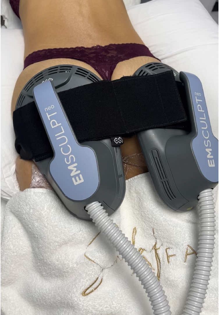 Sculpt, tone, and strengthen your glutes with Emsculpt Neo 🍑 This treatment combines HIFEM technology and radiofrequency to build muscle and burn fat simultaneously. 💡 Why Emsculpt Neo for glutes? 🍑Lifts, firms, and defines your glutes without surgery 🍑Activates deep muscle contractions for a stronger, sculpted look 🍑Works the muscle without increasing your heart rate  Whether you’re looking for that peach-perfect lift or improved strength, this treatment delivers real results in just 30 minutes 🤍 #gluteworkout #glutesworkout #emsculptresults #emsculpt #emsculptneo #fatreduction #fatreductiontreatment #bodycontouring #bodysculpt #londonaesthetic 
