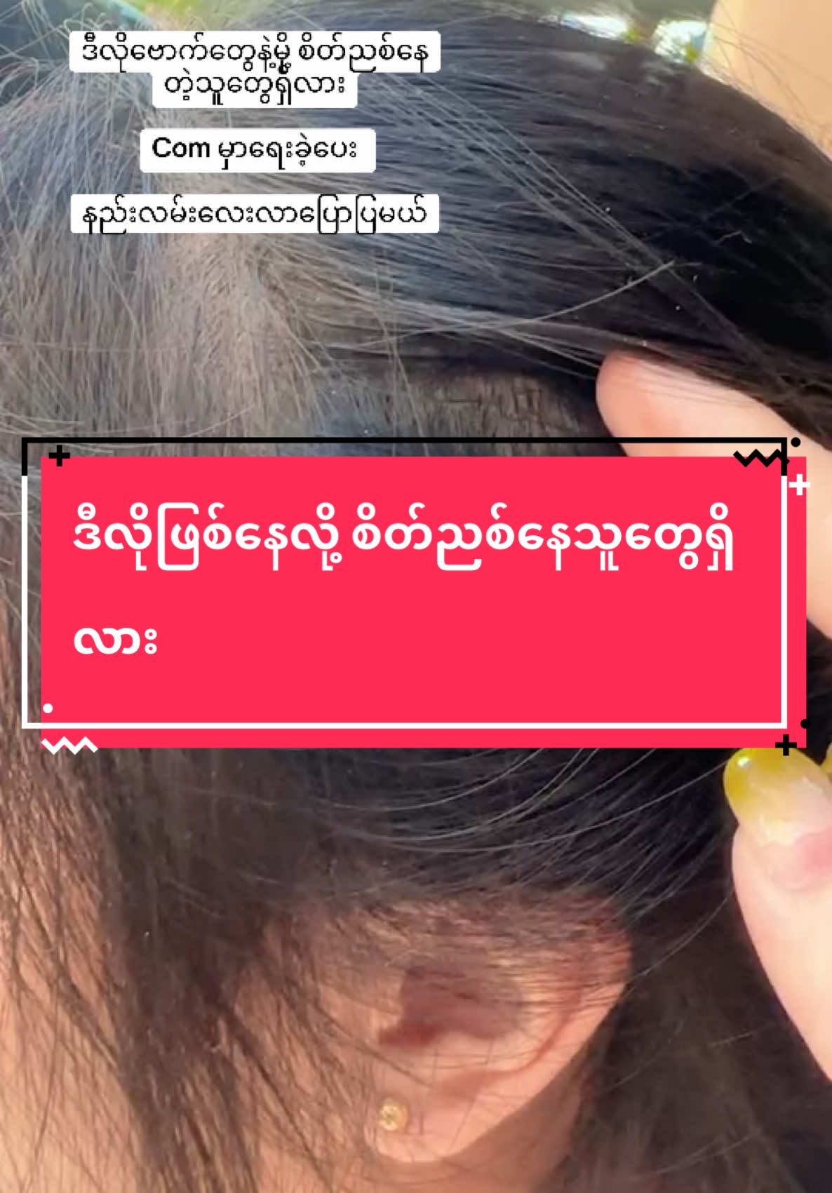 #hnineieilin4ibmyanmar #hnineieilin5ibmyanmar #YourBlessingsMyanmar #foryou #တွေးပြီးမှတင်ပါ #tiktokmyanmar #tiktokmarketplace #thanktiktok #foryoupage #tiktokuni #thankb4youdo #သာလီစြပါနန္႔🙏🙏🙏 #thankb4you #သာလီစြပါနန္႔🙏🙏 #shampoo #သဘာဝ #ခေါင်းလျှော်ရည် #လက်လီလက်ကားဝယ်ယူနိုင်ပါတယ်ရှင့် 