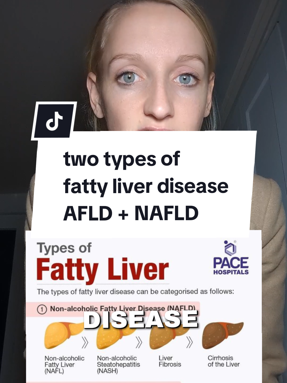 Inflammed liver/fatty liver disease #fattyliver #type2diabetes #inflammation #liver  #glucose #insulinresistance 