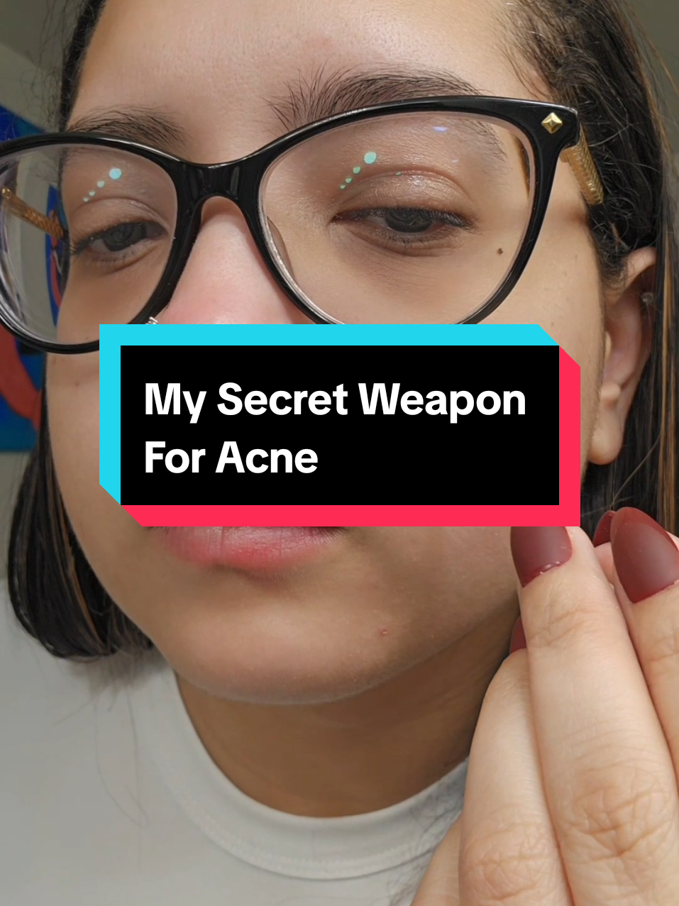 I could hype this Lanbena Acne Spot Serum all day but it truly speaks for itself. #lanbena #lanbenaproducts #acneskin #acne #newyearnewaura #skincareroutine #nighttimeskincare 