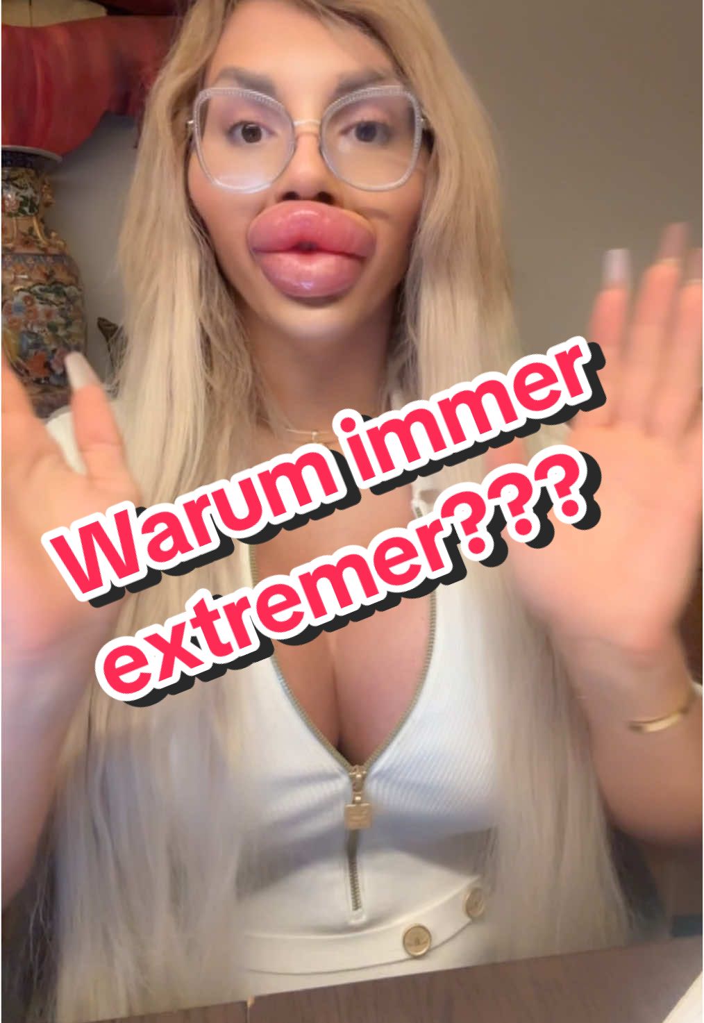 IG: Vienna.Xtreme #lipinjections #viennaxtreme #botox #trans #viennawuerstel #viennabotox @viennabotox @Jessy Bunny @Jessy Bunny @JessyBunny 