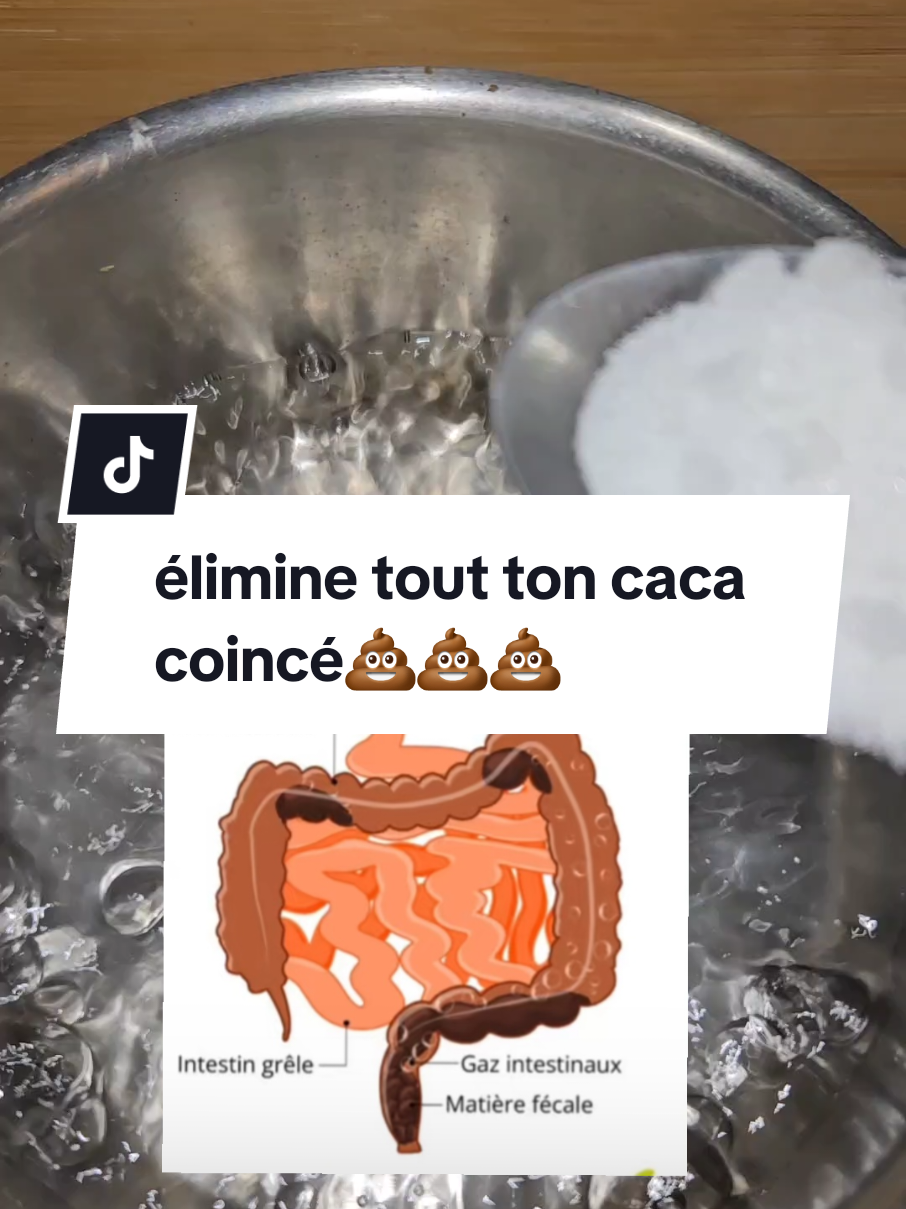 élimine ton caca coincé dans tes intestins avec ce remède maison📢💩💩 #pourtoii #fouryou #videoviral #santénaturelle #remèdenaturel #miracle #video #fyyyyyyyyyyyyyyyy #santé 