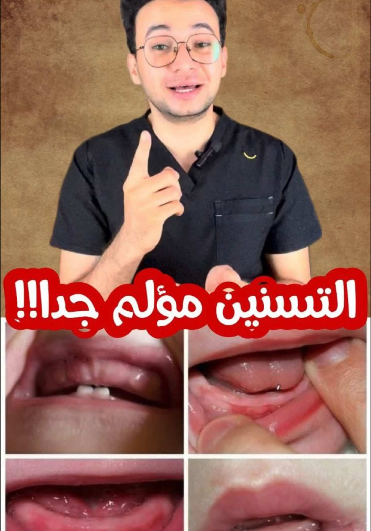 مش هتتخيلوا البيبي بيتألم ازاي اثناء التسنين😢💔  #dr7oss21 #viral #foryou #foryoupage 