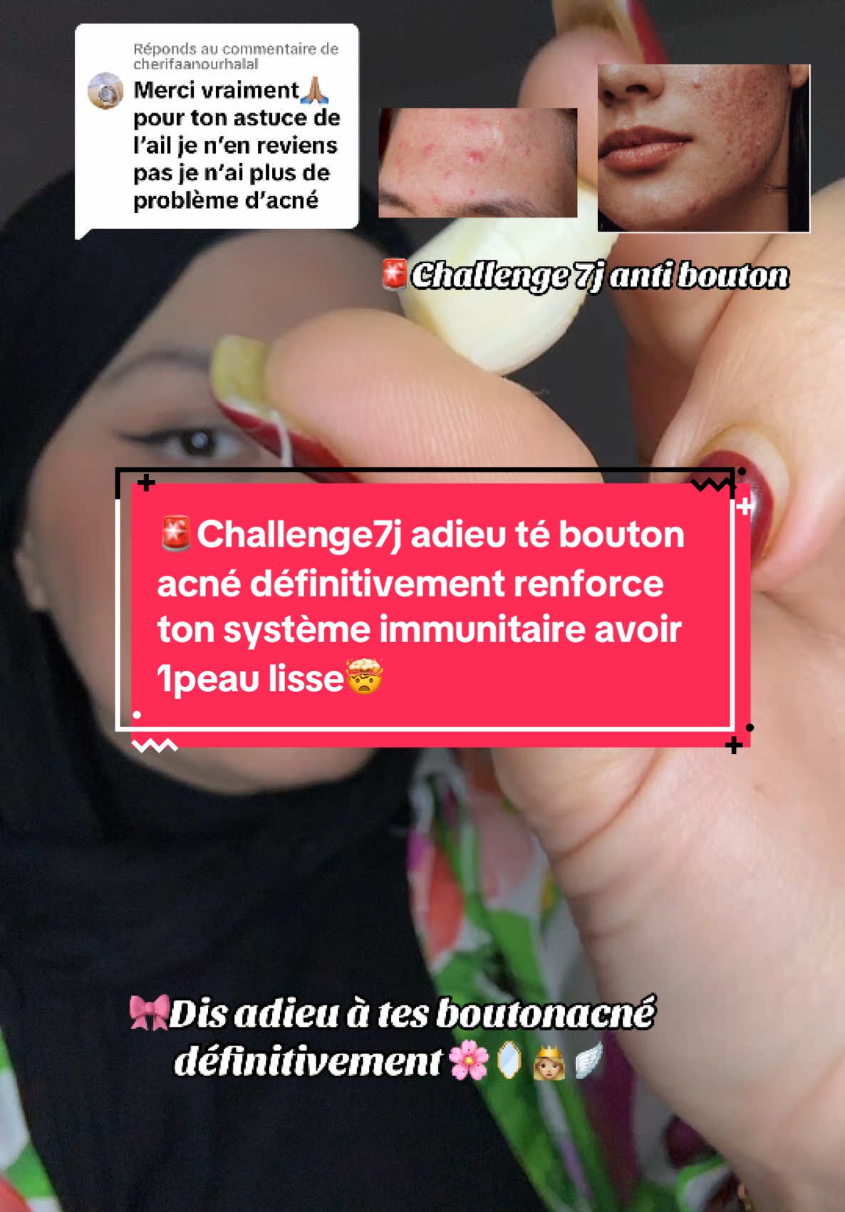 Réponse à @cherifaanourhalal  🚨Challenge7j adieu té bouton acné définitivement renforce ton système immunitaire avoir 1peau lisse🤯 . . . #challenges_tiktok #systemeimmunitaire #boutondacné #boutonblanc #glasskin #skincare  @Garder le sourire 🇹🇳🇫🇷🕊️  @Garder le sourire 🇹🇳🇫🇷🕊️  @Garder le sourire 🇹🇳🇫🇷🕊️ 