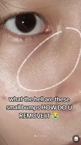 i saw someone still struggling on their tiny bumps, so here’s my recommendation! ##niacinamide #niacinamideserum #dermorepubliqserum #tinybump #tinybumps #tinybumpssolution #clearskin #fyp #foryou 