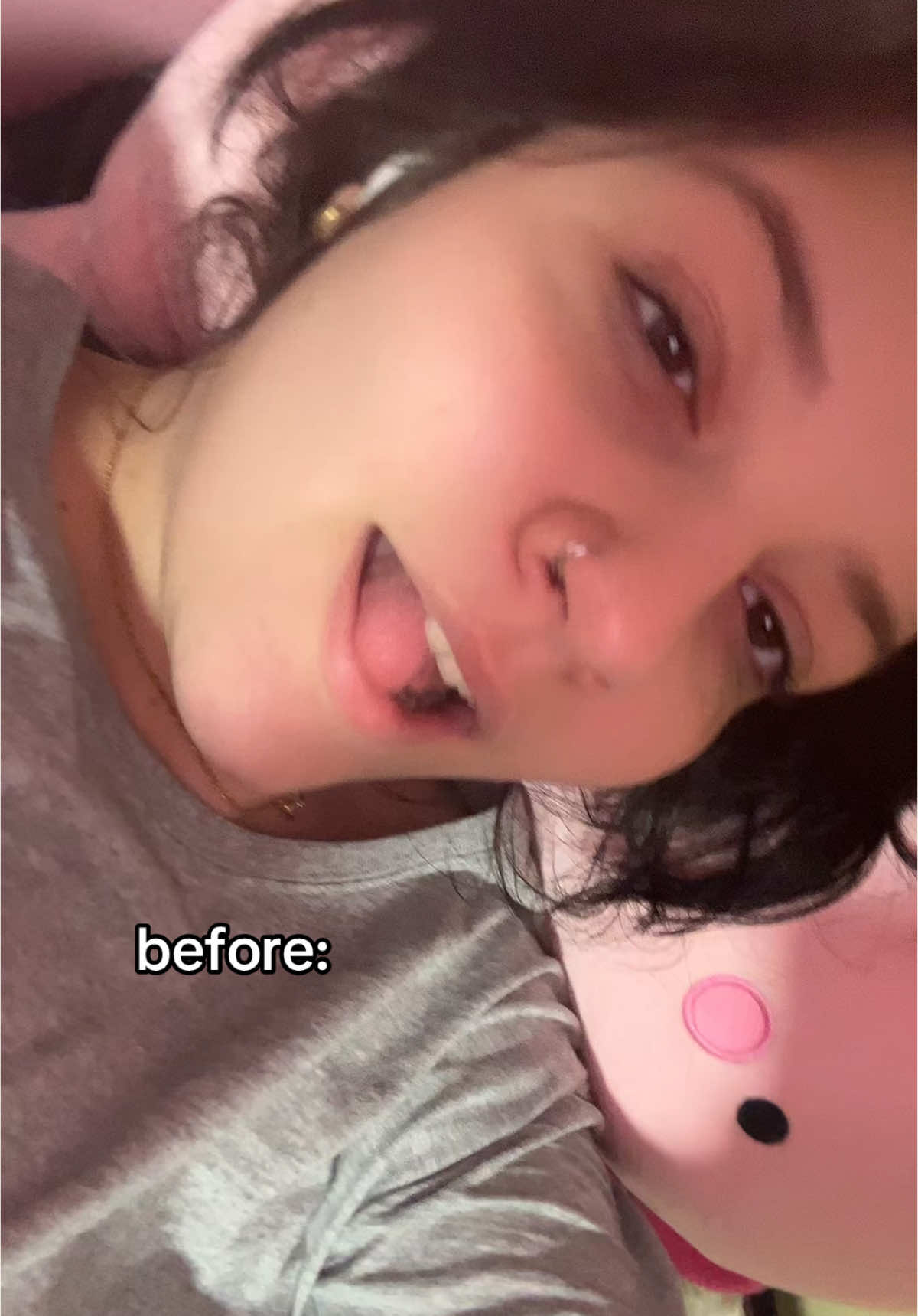 i reccomend getting ur tongue pierced it overall wasnt bad at all. #toungepiercing #piercing #piercingsoftiktok