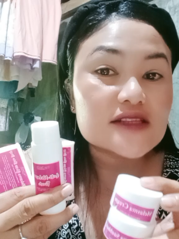 ganda talaga ng resulta. #antimelasmaset #melasmaset #skincare #skincaretips