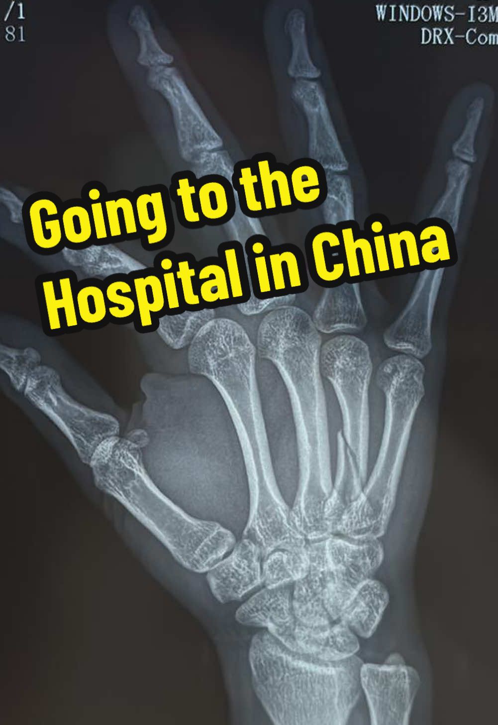 Visiting the emergency room in China for a broken bone 🦴 #china #2025 #hospital #lifeinchina 