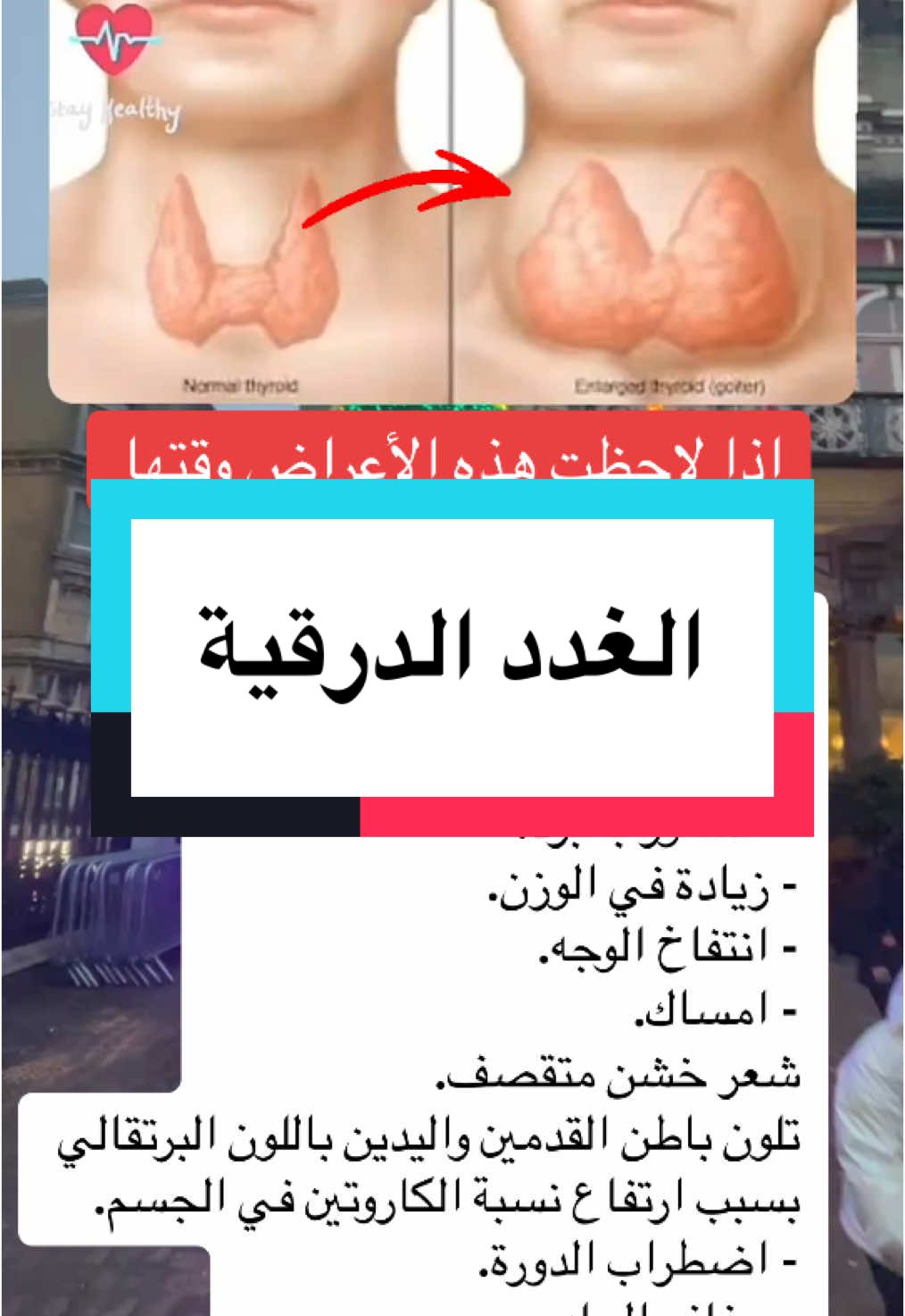 اذا لاحظت هذه الأعراض وقتها يجب فحص الغددالدرقية#طبيب_تيك_توك #علاج_طبيعي #اعشاب_طبيعيه_فوائد #فوائد #نصائح_مفيدة #معلومات_مفيده #صحة_عامة #تيم #اكسبلور #علاج_بالاعشاب #طب_صيني #fypy #fyp #for #viralllllll #foryo #الغدد_الدرقية 