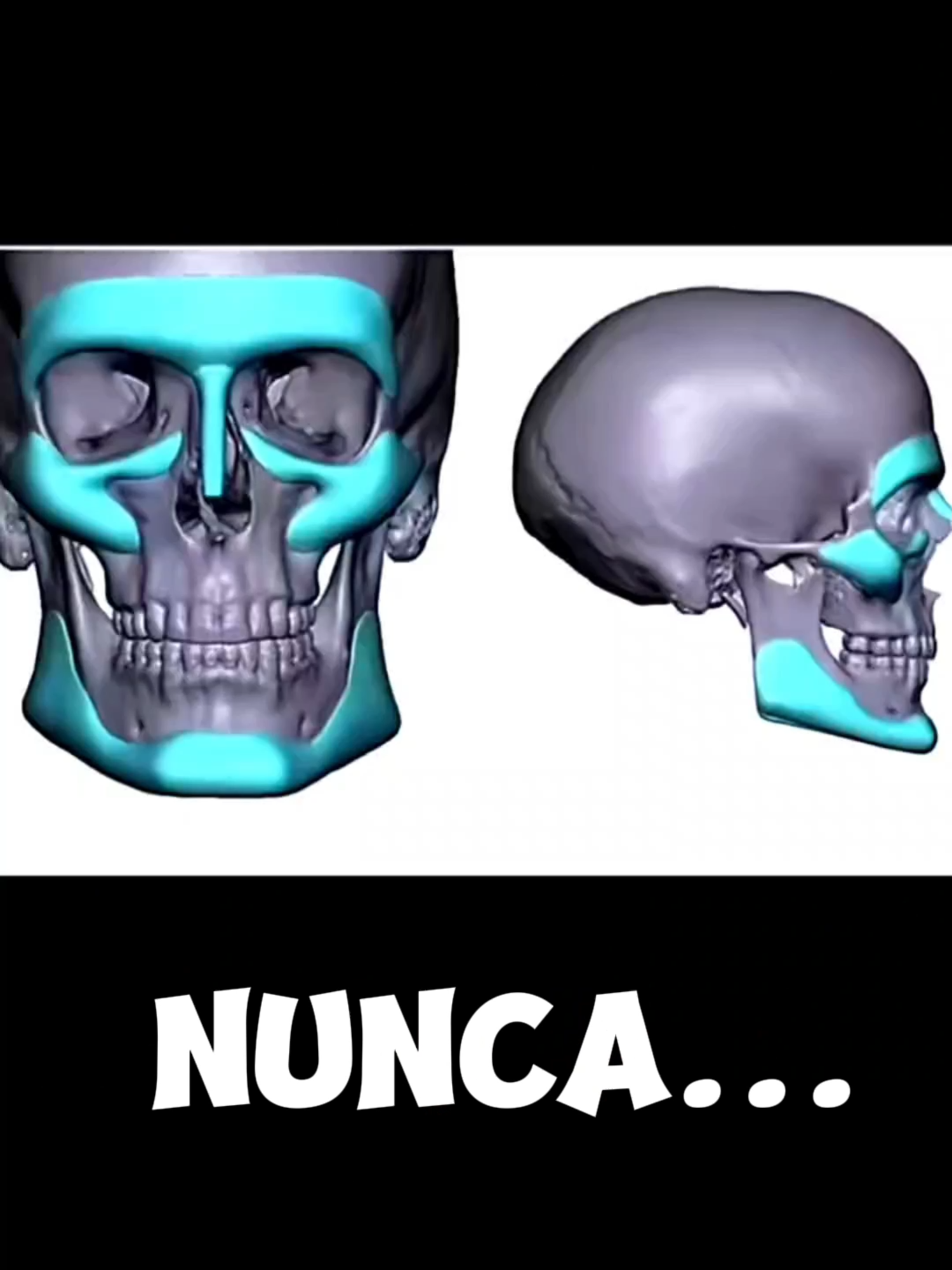 Audio que recebi na época,ultimo edit tbm, agora vou dar apenas dicas quem tiver alguma duvida só me perguntar vamos evlouir juntos  #looksmaxing #mog #fyp #looksmax #looks #mogged