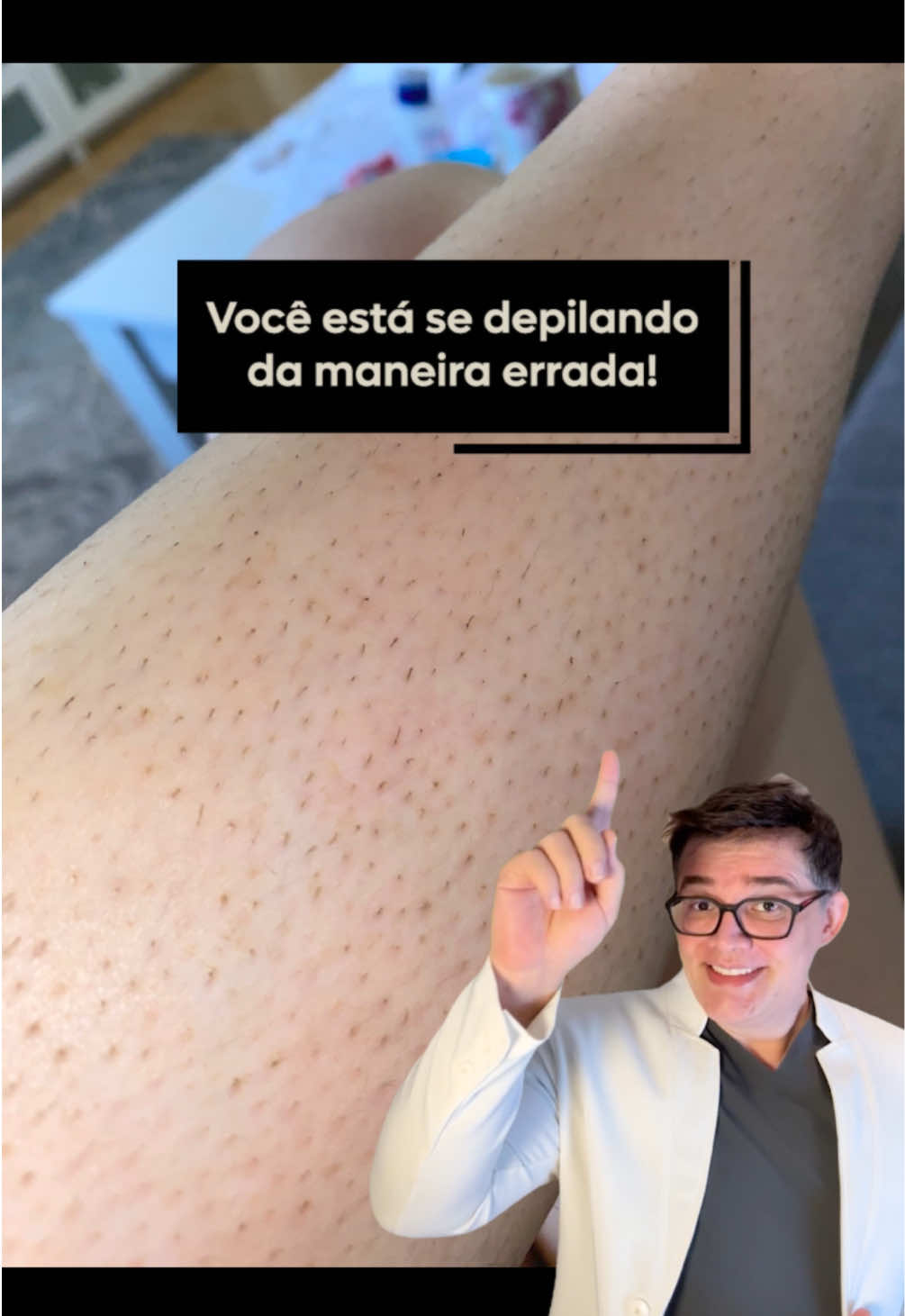 Você sabia que a direção em que você se barbeia pode impactar diretamente a saúde da sua pele? 🪒✨ Muitas pessoas acreditam que barbear-se contra o grão do cabelo proporciona um barbear mais rente. No entanto, essa prática pode aumentar o risco de cortes, irritações e até pelos encravados. ⚠️ ➡️ Para um barbear mais suave e saudável, comece raspando na direção do crescimento do cabelo. Isso reduz o atrito, evita danos à pele e ajuda a manter a hidratação natural. O uso da gilete é rápido e prático, mas não está isento de riscos. A foliculite, uma inflamação dos folículos pilosos, é uma condição comum que pode ocorrer devido ao atrito e ao corte superficial dos pelos. 🧴💧 E você, já conhecia essa dica para um barbear mais seguro? Conta pra gente nos comentários! 👇 #depilação #barbeador #irritação #dicas #pele #foliculite #pelosencravados #cabelo #pelo #dermatologist #dermatologista #brasilia #foliculospilosos