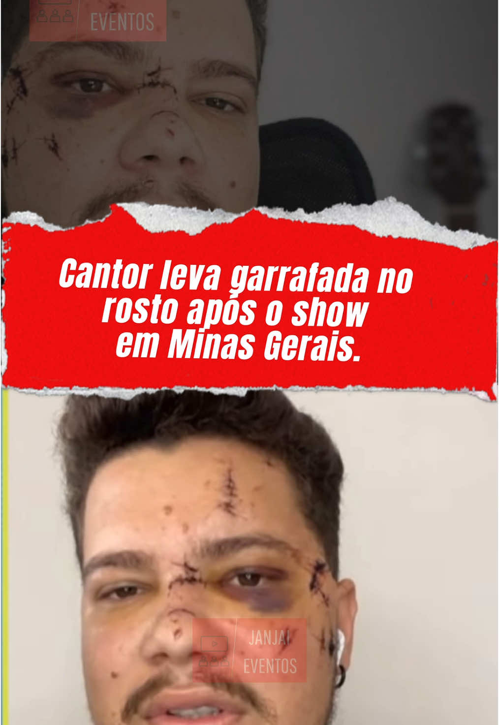 Benício, cantor sertanejo da dupla Hermes e Benício, sofreu uma agressão com garrafada durante um show de Réveillon em João Pinheiro, no interior de Minas Gerais. O suspeito, de 27 anos, foi preso após o ataque, afirmando em depoimento que reagiu ao ver Benício beijando sua esposa. No entanto, testemunhas presentes no evento negaram a versão do homem. Benício, que ficou com o rosto desfigurado devido à agressão, está em observação médica. . . 🎥 SBT News  #noticia #cantor #musica #show 