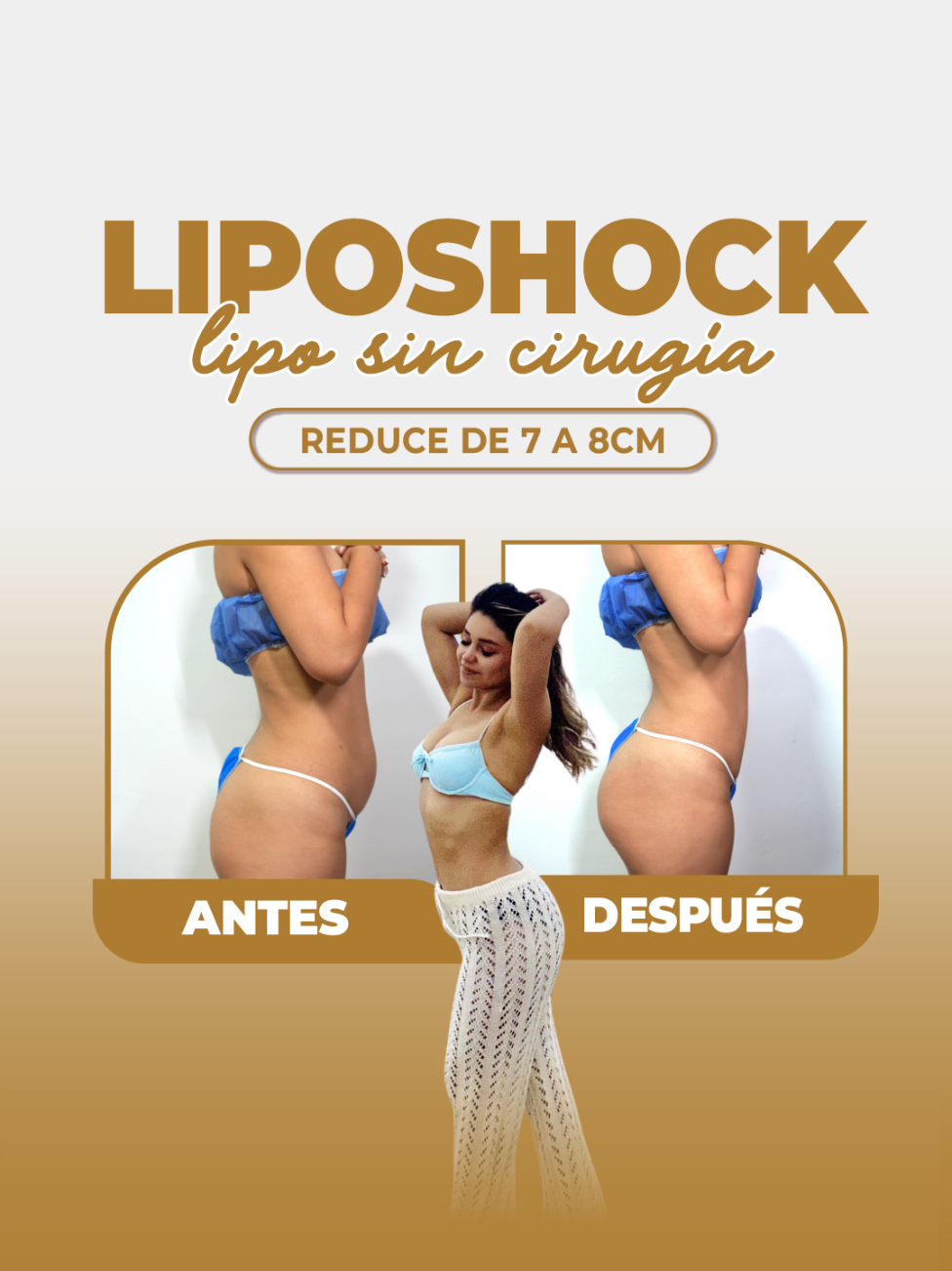 LIPOSHOCK 💪🏻la nueva LIPO sin cirujía Es un tratamiento mucho más efectivo que la Hidrolipoclasia ,  ya que este tratamiento se utiliza la micro cánula, que consiste en romper la célula más rebelde que ni con dieta y ejercicio puedes bajar. Este tratamiento es traído directo de EEUU Zonas a tratar :  🪷Abdomen 1 zona  🪷Espalda 2 zonas  Beneficios : ✓tratamiento indicado para reducir grasa localizada  ✓reduce la celulitis  ✓moldea distintas zonas del cuerpo  Reduce de 7 a 8 centímetros  #Dulcemaria #liposhock #lipo #nocirugia #medicinaestetica 