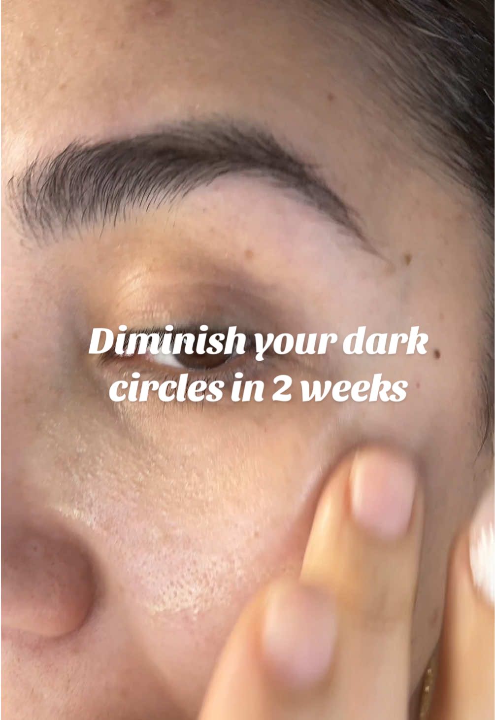 Don’t miss out on @Murad Skincare dark circles correcting serum and it’s 40% off with free shipping!! #muradskincare #darkcircles #vitamincserum #eyeserum #undereyecircles #darkcirclesundereyes #fyp 