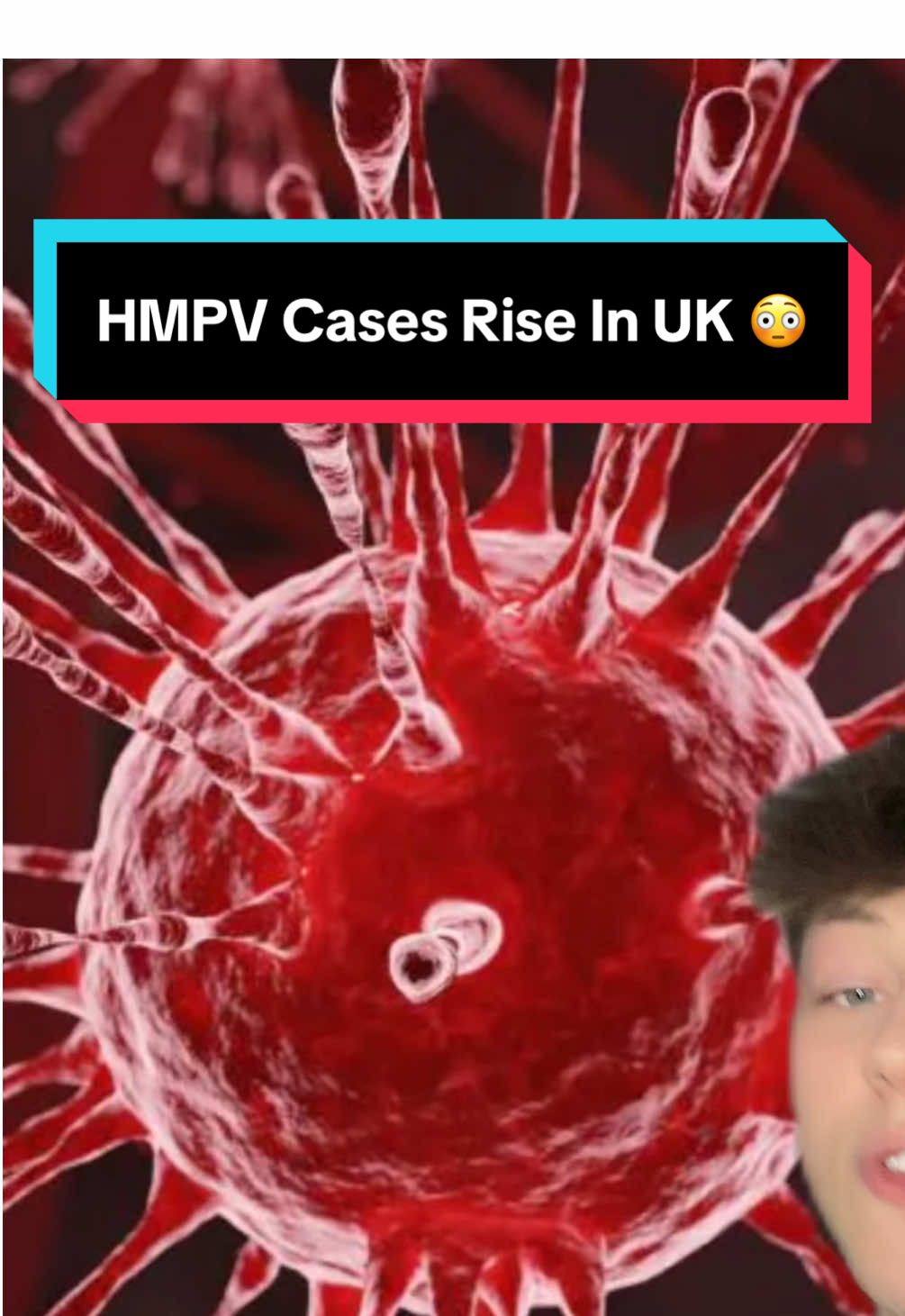 HMPV Cases Rise In UK 🤔 #hmpv #virus #illness #outbreak #disease #lockdown #nhs 