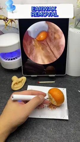 You can use the ear scoop of the camera#earpick #gift #friend #children 