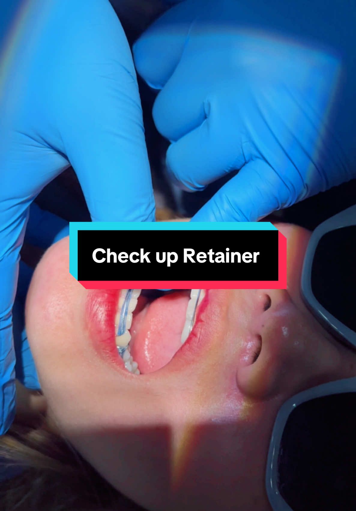 Check up Retainer #គ្លីនិកធ្មេញគ្រេតស្មាល #គ្លីនិកធ្មេញគ្រេតស្មាល #greatsmiledentalclinic #teamធ្មេញដែក #ព្យាបាលធ្មេញ 