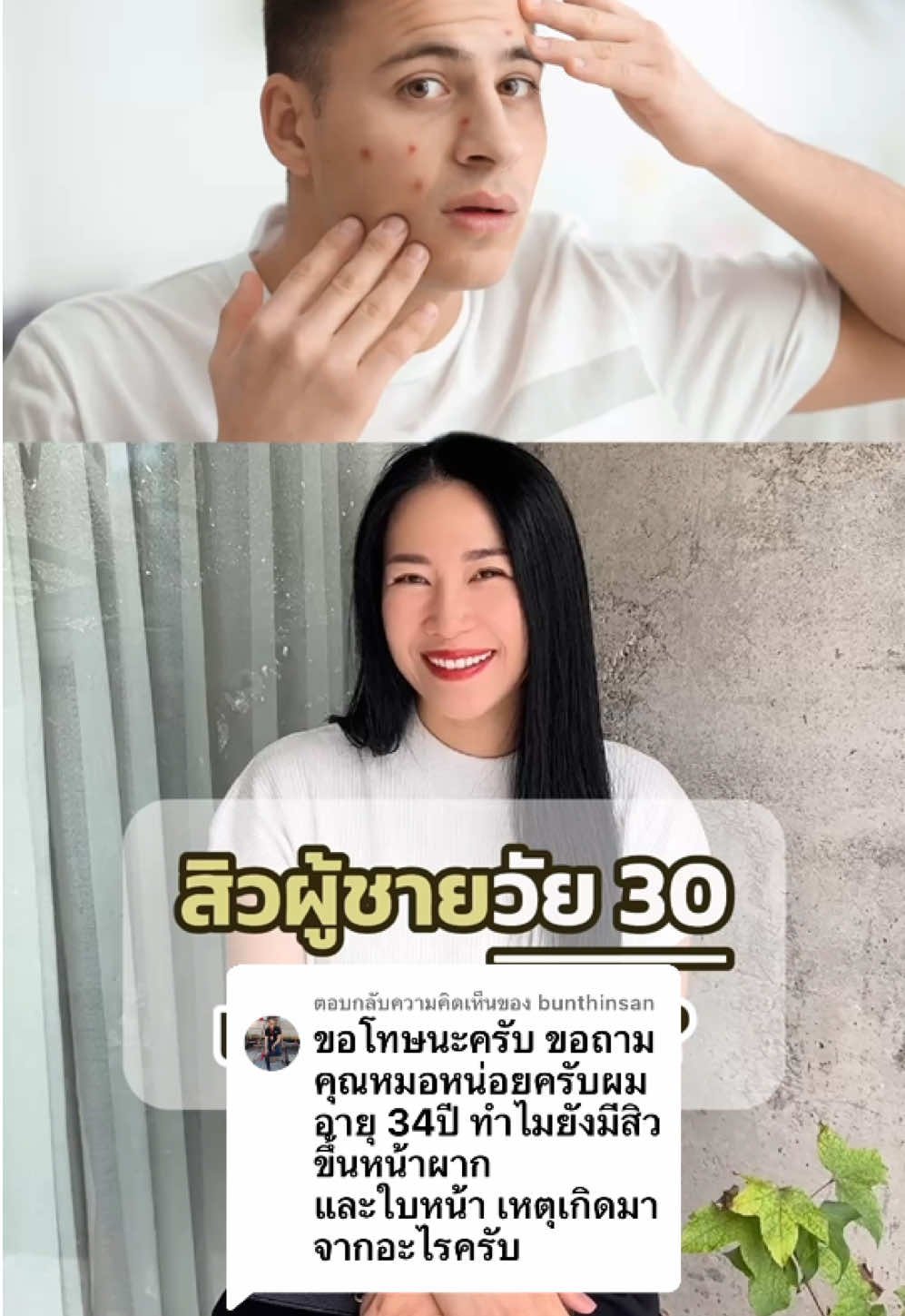 ตอบกลับ @bunthinsan  #สิว #ผู้ชาย  วัย 30+ เกิดจากอะไร ? #เภสัชออยลี่ #เภสัชออย #เภสัชออยแก้ปัญหาวัยทอง  #tiktokshopครีเอเตอร์ #tiktokshopcreator #tiktokuni #ความรู้tiktokshop #สอนให้รู้ว่า #สุขภาพดี #tiktokสุขภาพ #tiktokhealth #longervideos 