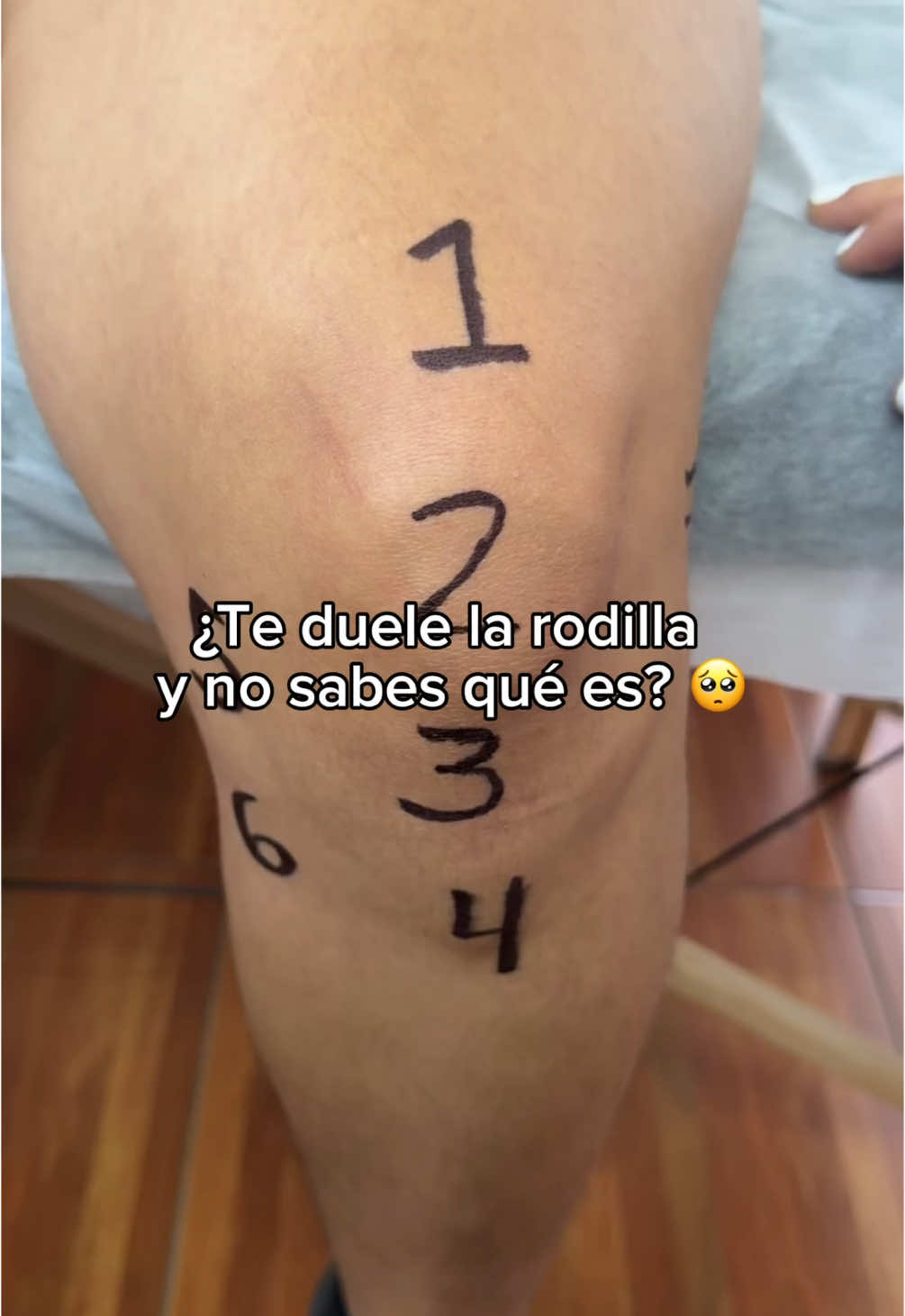 ¿Sientes dolor en la rodilla y no sabes cuál es la causa? 🤔  Te explicamos qué parte de la estructura de la rodilla podría estar afectada según la zona del dolor.  #fisioterapia #agendaabierta #rodillas #dolor #tratamiento #agendaya 