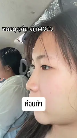 จมูกครบ14วันนน😍 #หมอบุญถิ่น #บุญรัตน์คลินิก #จมูก 