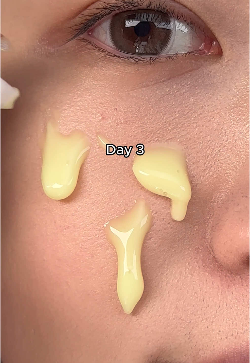 #skincare #skintok #kbeauty #koreanskincare #skincareroutine #7days #retinalserum #acneserum #poreserum #rednessserum #trendingskincare #koreangirl #fyp #pores #foryourskin #inaweek #enlargedpores 