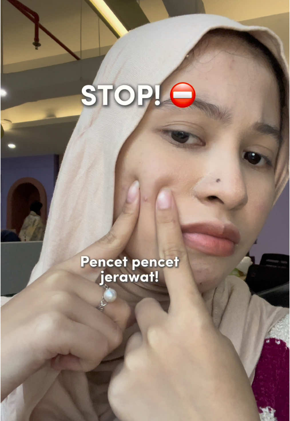 Ada jerawat muncul?! Jangan dipencet!⛔️😱 Bahaya loh!! Mending pakai totol jerawat dari Skindoze! Jerawat kamu akan kempes dan tidak meninggalkan jejak!🥹✨ #diskon #promo #fyp #skindoze #jerawat #totoljerawat #acne #acneskin #flashsale #EGF