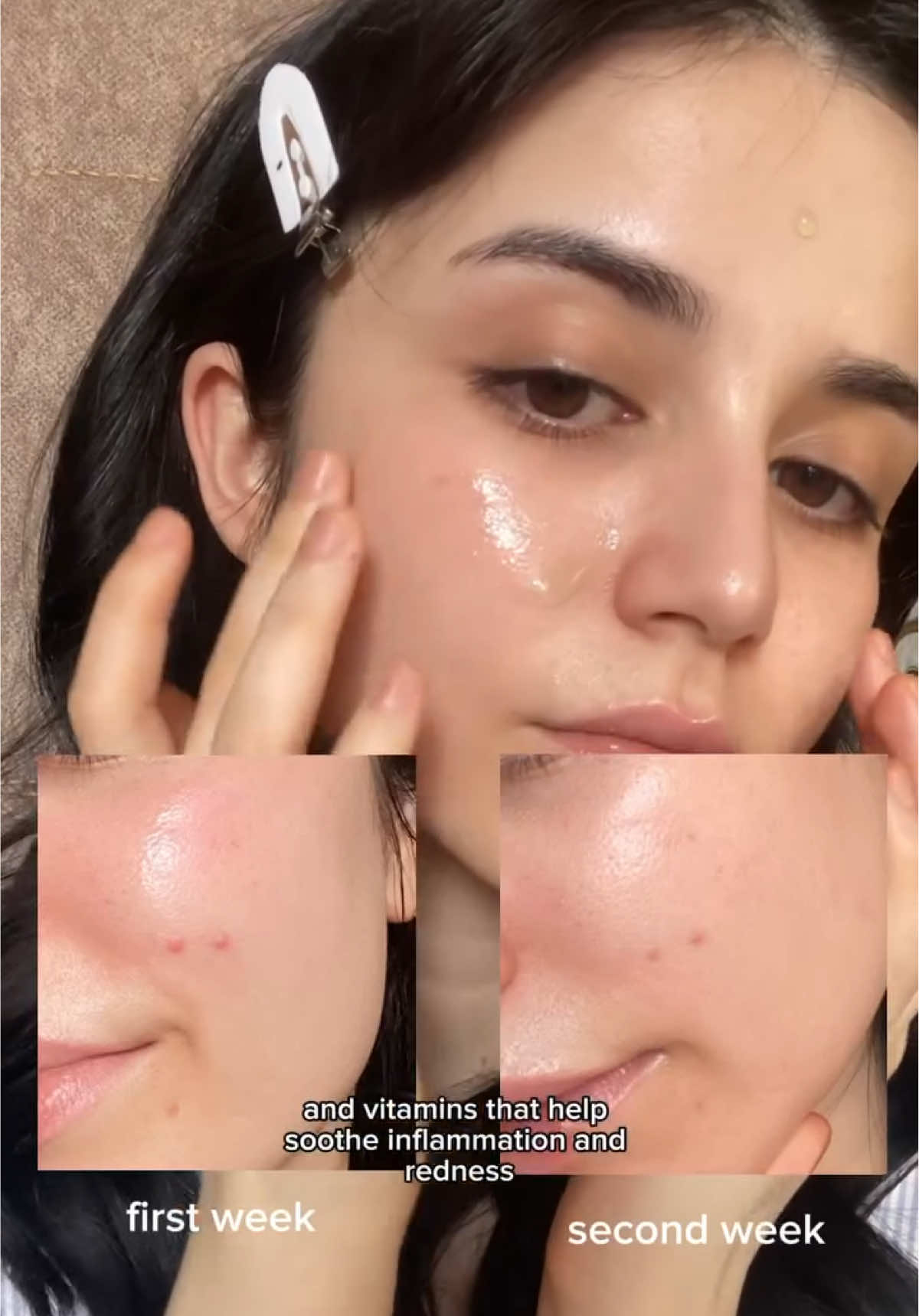 How to achieve the perfect base for any a no makeup makeup look! 🤍✨  #celimax #skincare #fyp #viral #noni #skin #serum #kbeauty #kbeautyskincare #moisture 