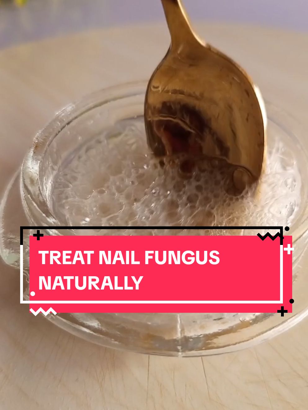 How to treat nail fungus Naturally. #nailfungus #nails #nailfungustreatment #naturalrecipes #naturalRemedies #nailcare 