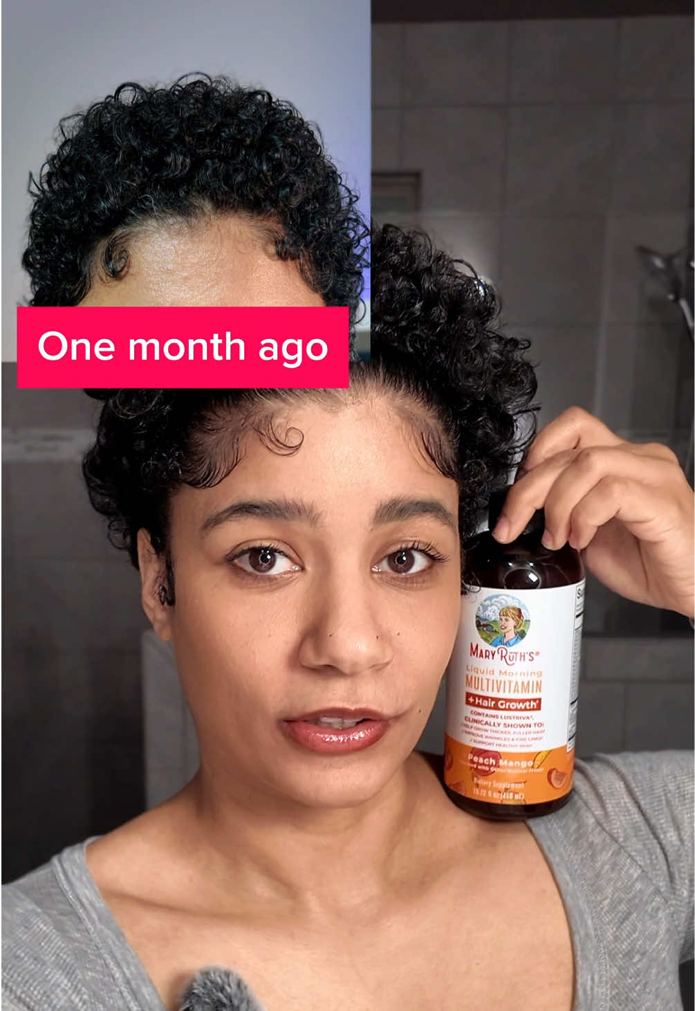 Don’t wait! My hair grew in 10 days!! 🫨 My goal is to grow my hair down my back and I am confident I can do it with this! Especially with the price being this good on the tiktok shop - I checked other places and finally went for it. I’m very satisfied! ♥️ #hairgrowth #hairgrowthtips #curly #naturalbeauty #SuperBrandDay #MaryRuthsSuperBrandDay