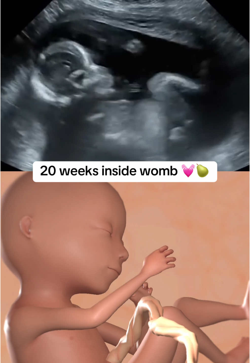 20 weeks pregnant 🍐💓 the 3D baby is so realistic 😱 #pregnancy #baby #momtobe #fyp #ultrasound #1sttrimester #wemoms #pregnantbelly 