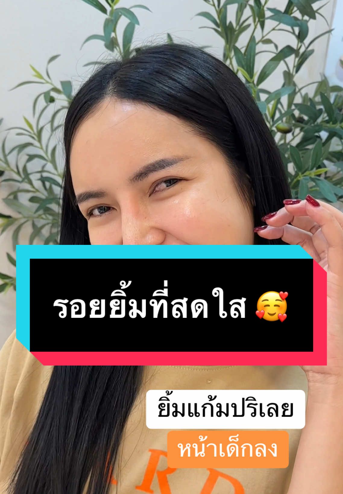 #เทนด์วันนี้້ ปรับรูปหน้าครบสองสัปดาห์กลับมาf/u ชอบในความน่าละมุนมาก 🥰💕#artehouseclinicสาขารังสิต #artehouseclinic #Tiktoklooks #รีวิวบิวตี้ในtiktok🥀🌺🌍 #ฟิลเลอร์ #รีวิวบิวตี้ในtiktok #รีวิวบิวตี้    