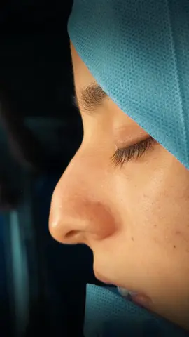 ¿Están listos? 🪄✨ #rinomagia #beforeandafter #fyp #rhinoplasty #surgerytiktok #foryoupage❤️❤️  #cirugia #cirugia #surgery #belleza #rinoplastia
