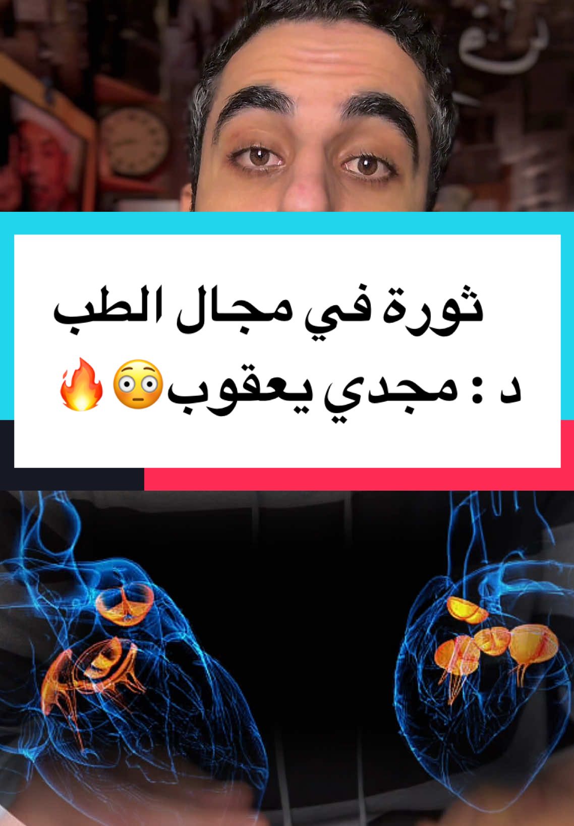 انجاز جديد ل الدكتور مجدي يعقوب في الطب ☝🏻♥️