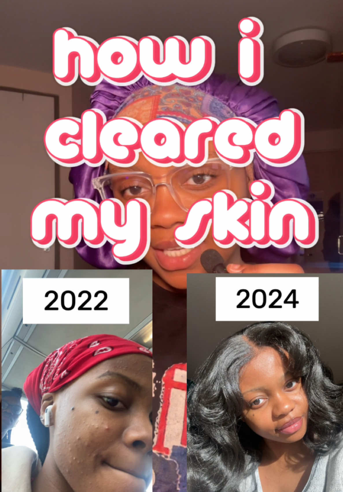 PLEASE don’t scroll, this took a while to make ☹️ I hope this helps someone 🩷☺️. @CeraVe #skincareroutine #cerave #skincare #foryoupage #skincaretips #clearskin #fyp 