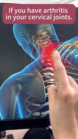 The neck is stiff and the pain is unbearable.#workoutinspo#gymmotivation #dolor#pain#fyp#foryoupage