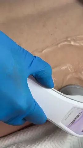 Diga adeus aquela gordurinha nas costas com Avatar Esthetic. 👋 Com Avatar Esthetic você encontra protoclos prontos, potência de 30W, era de 10cm² e duas frequências de 2750KHz e 950KHz . Garanta a melhor tecnologias para sua clinica, quer saber mais? Comente 