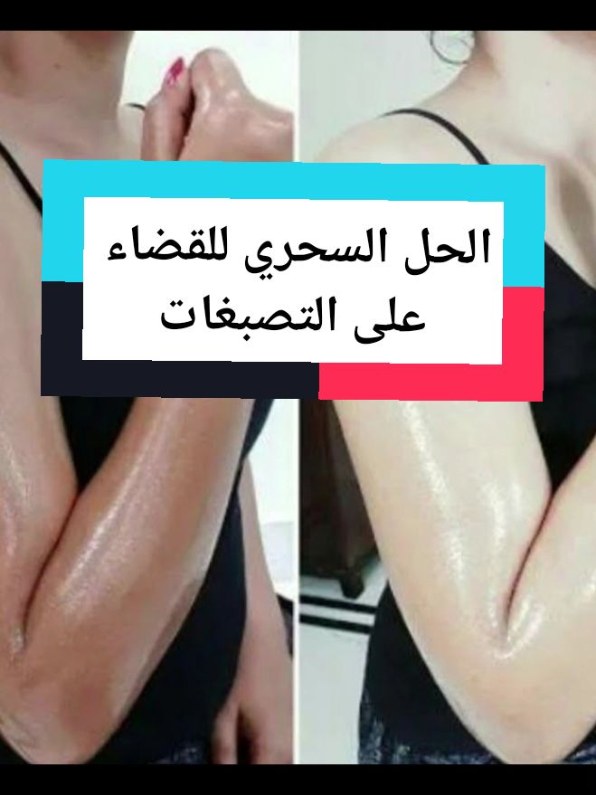 #skincare #توحيد_لون_البشره #ماسكات_للوجه #وصفات_سهله #وصفة_طبيعية #ماسكات_للوجه #الصحة_والجمال #وصفات_طبيعية #الجمال_ 