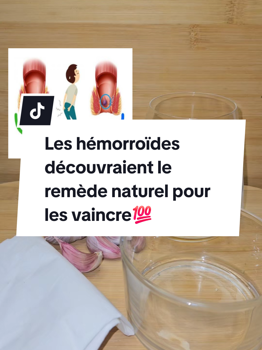 Les hémorroïdes découvraient le remède naturel pour les vaincre🔥 #videoviral #hémorroïdes #video #santénaturelle #santé #fb #tik_tok #pourtoii #remèdenaturel #explore #frypgシ #explore #fyp #pourvous #fouryourpage #miracle 