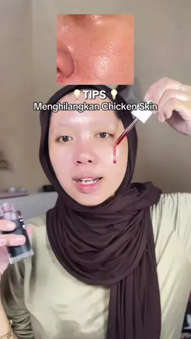 [SAVE] buat punya chicken skin biar cepet ilang✨ #ceritaiketia #pejuangglowup #pejuangglowing #chickenskin #caramenghilangkanchickenskin #tipsskincare #eksfoliasi #skincaretips #peelingserum #peelingserumelformula #elformulapeelingserum #peelingserumviral #fyf 